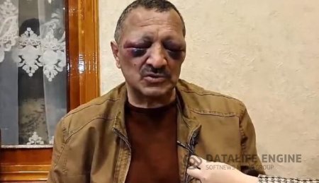 ABŞ səfiri Din tərəfindən işgəncəyə məruz qalan Tofiq yaqublu ilə görüşüb.