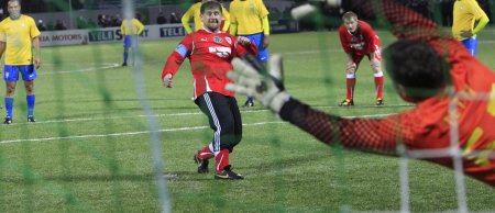 Çeçenistan prezidenti futbol zamanı ayağını zədələyib - FOTO