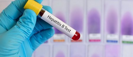 Ötən il Azərbaycanda hepatit B və C virusundan ölənlərin sayı açıqlanıb